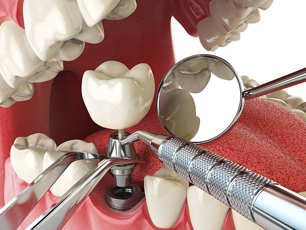 Best Urgent Care for Lost Fillings or Crowns in Franklinton, LA