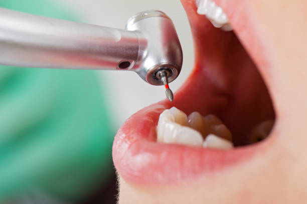 Best Emergency Dental Care for Broken or Chipped Teeth in Franklinton, LA